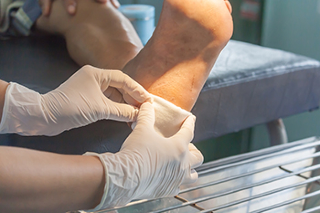 How Podiatrists Treat Pressure Injuries on the Feet